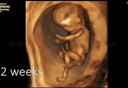 4D ultrasound pregnancy of 12 weeks fetus moving dancing Gynecologist