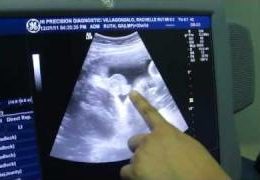 7th months ultrasound of baby alex….